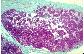 Ganglion lymphatique de chien.   TM   PG
