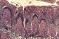 Amygdale palatine.   TM   MG